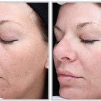 30 Minute Fast Glow Facials